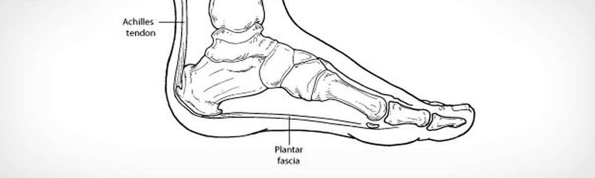 Line drawing of the foot in side profile showing the Achilles tendon and the plantar fascia running from the heel to the toes